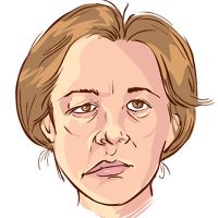 Peripheral paralysis