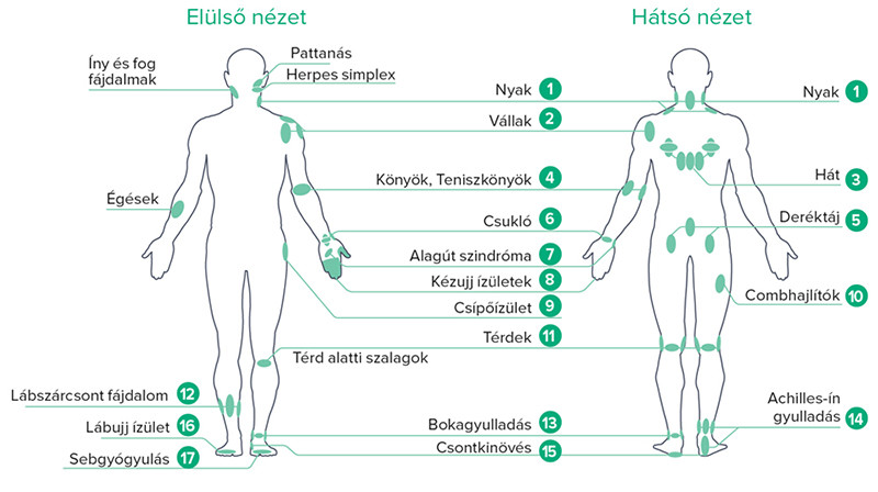 B-Cure laser therapy points