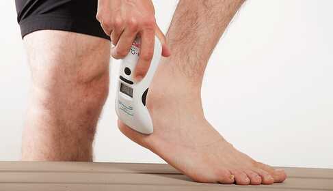 Soft laser for treating heel pain – Heel spur, plantar fasciitis