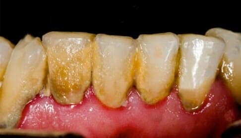 Why Is the Health of Our Teeth Important?