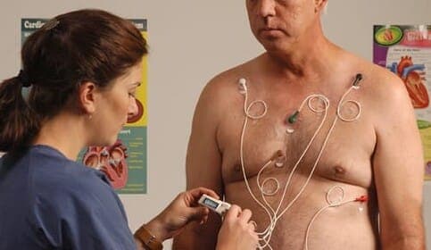 Information about the Holter ECG examination