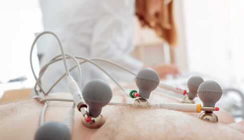 ECG – what you need to know about the electrocardiographic examination