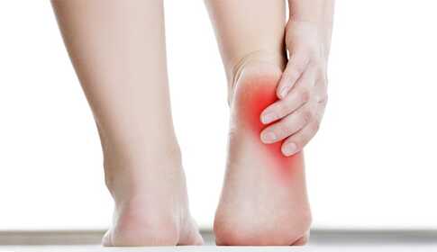 Acetic Acid Iontophoresis in Heel Pain and Heel Spur Treatment