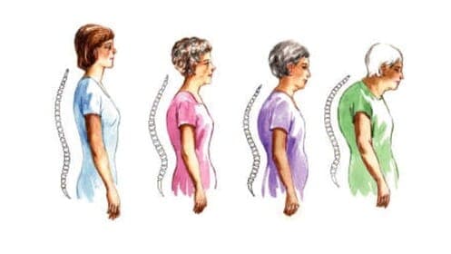 Osteoporosis and Magnetic Therapy – Home Adjunct Treatment