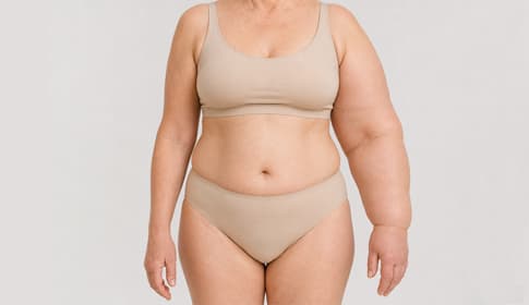 Arm swelling after breast cancer treatment (BCRL)