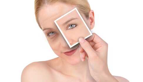Dark circles under the eyes – what should you know about them?