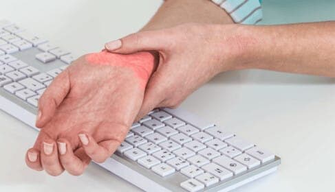 Carpal Tunnel Syndrome – What You Need to Know About Prevention and Treatment