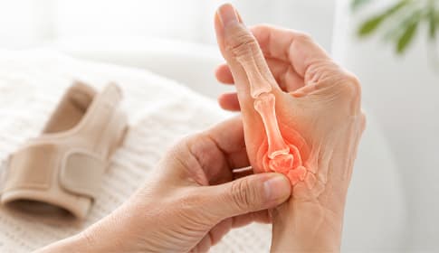Home treatment for thumb carpometacarpal (CMC‑I) osteoarthritis