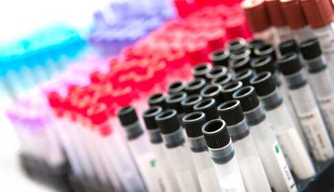 What is a screening test and what is it good for?