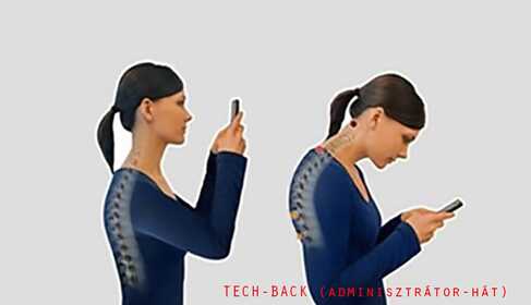 Causes, Symptoms and How to Eliminate Tech‑back
