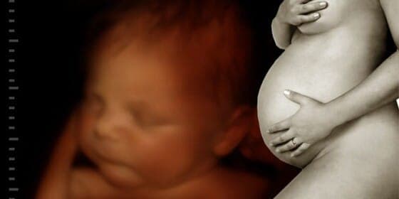 Pregnancy varicose veins: what truly makes pregnancy 