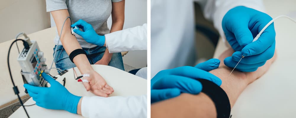 EMG electromyography exam