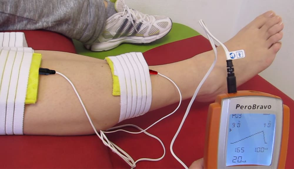 using the PeroBravo device for peroneal therapy