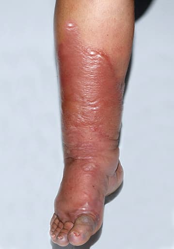 orbánc megjelenése