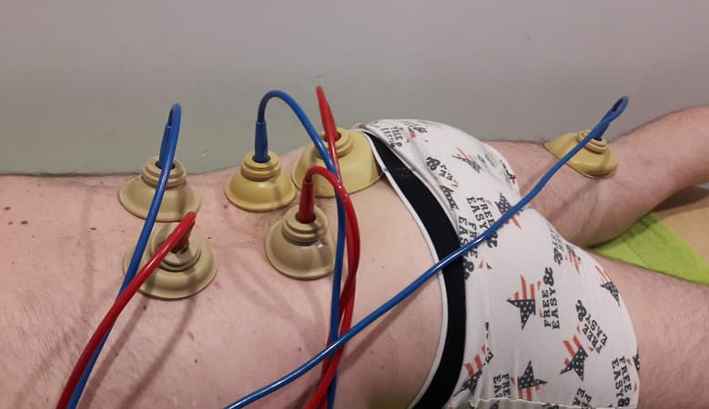Sciatica treatment with vacuum electrodes