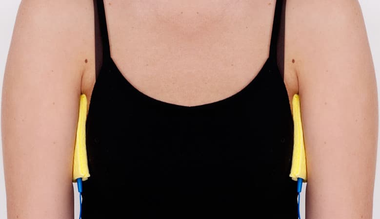 underarm sweating treatment with iontophoresis