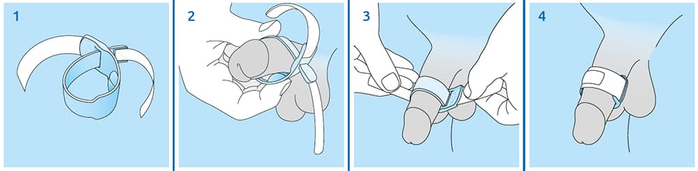 Medintim Prosecca band usage