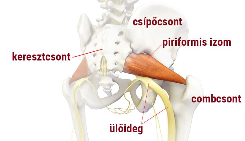 causes and treatment of piriformis syndrome