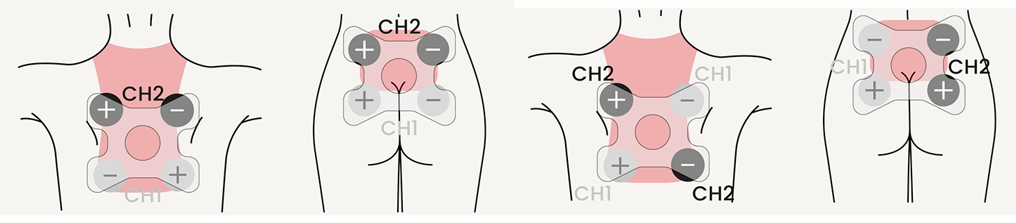 Back Pain Electrode