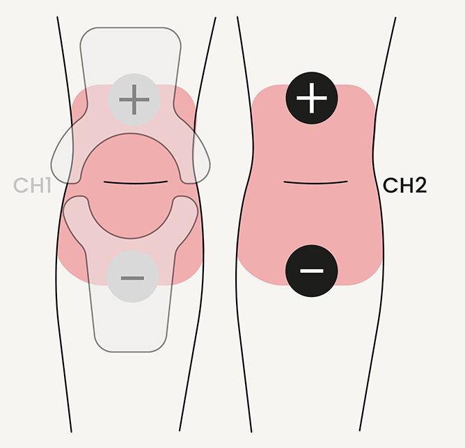Knee-pain-electrode