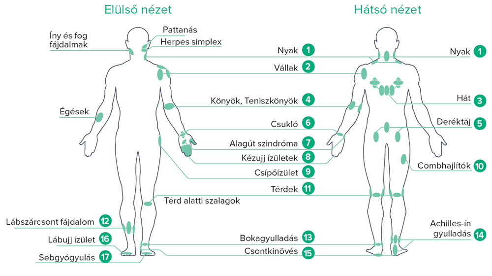 B-Cure-laser-therapy-points.jpg